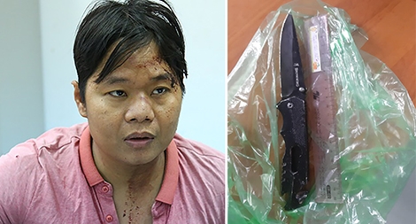 Hậu quả từ những "cái đầu nóng"...