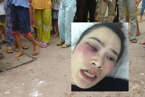 Nam sinh viên đánh phụ nữ nhập viện tại quán bánh xèo