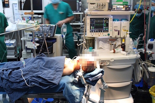 Phẫu thuật thành công cho 2 bệnh nhi động kinh bằng kỹ thuật mới