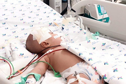 Cứu sống một bệnh nhi bị viêm màng não nguy kịch