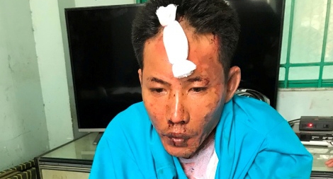 Mâu thuẫn với tình cũ, gã đàn ông mang xăng đốt cả 3 mẹ con