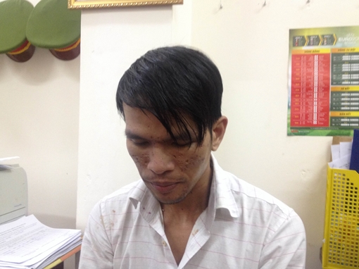 Khởi tố kẻ hành hạ cháu bé hai tuổi người Campuchia