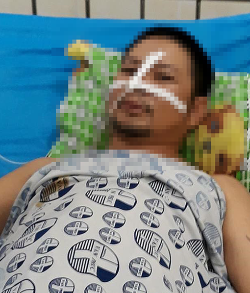 Một “hiệp sỹ” Bình Dương bị đâm trọng thương