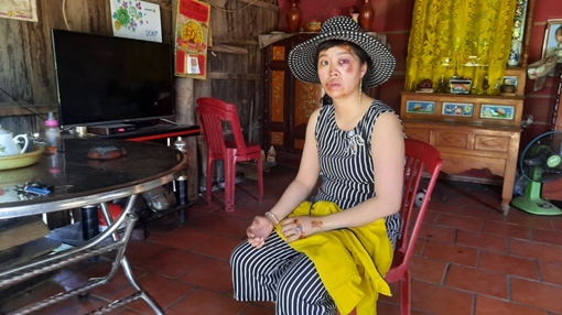 Truy lùng đối tượng liên quan 2 vụ cướp giật táo tợn tài sản của phụ nữ 