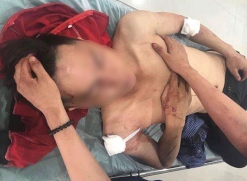 Đến công ty lĩnh lương, nam nhân viên bị đâm trọng thương, cướp tài sản