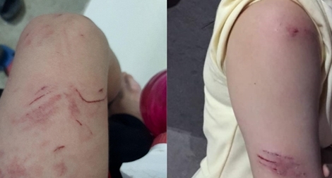 Đàn khỉ tấn công gây thương tích người dân 