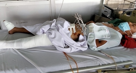 Bắt kẻ cướp manh động, một Công an xã bị thương nặng