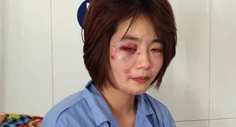 Khởi tố vụ án nhóm đối tượng hành hung nữ nhân viên xe buýt