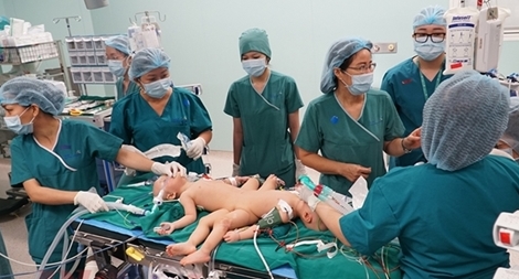 Bắt đầu ca đại phẫu tách rời cặp song sinh phức tạp nhất Việt Nam