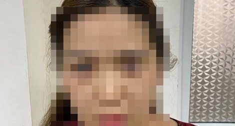 Nữ y tá ngủ với khách nước ngoài để trộm cắp  tài sản