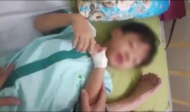 Bị chó cắn, bé trai 5 tuổi tử vong