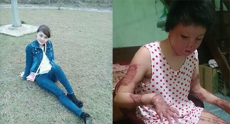 Tạm giam người chồng đổ xăng thiêu vợ vì đòi ly hôn