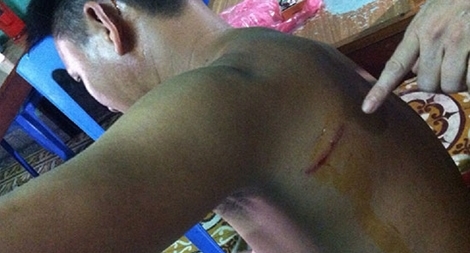 Xông vào nhà dân chém người lúc sáng sớm