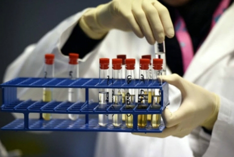 VĐV Malaysia "dính" doping tại SEA Games 29