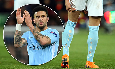 Vì sao nhiều cầu thủ ra sân với đôi tất rách?