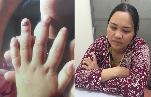 Người phụ nữ hành hạ dã man con riêng của bạn trai