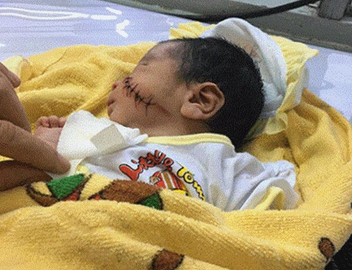 Bé trai 1 ngày tuổi bị chôn sống đã qua cơn nguy kịch