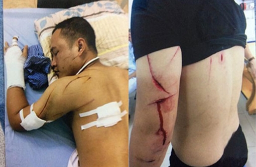 Thông tin về vụ cố ý gây thương tích xảy ra tại huyện Thuỷ Nguyên