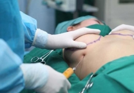 Đừng đánh đổi tính mạng vì làm đẹp