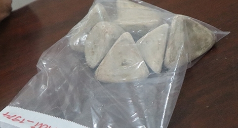 Lấy 0,5kg sỏi từ bàng quang của bệnh nhân