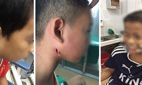 Cảnh giác và đối mặt với Whitmore