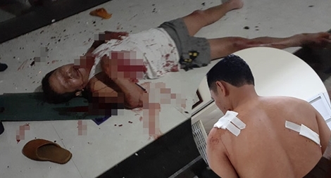 Điều tra vụ một gia đình bị hành hung dã man