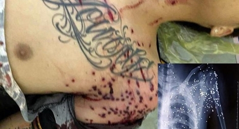 Súng nổ gần trạm BOT, 1 người bị thương