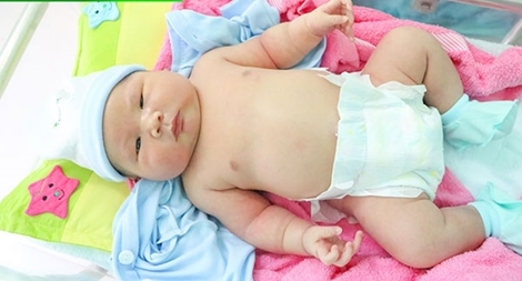 Bé trai cân nặng 5,2kg chào đời