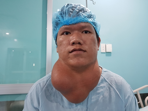 Sống chung u khổng lồ 2kg trên cổ hơn 25 năm.