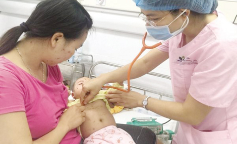 Biến chứng bệnh thủy đậu có thể dẫn tới tử vong