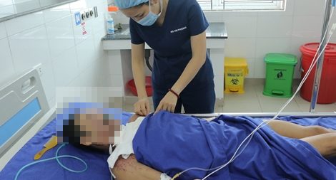 Cứu sống bệnh nhân cưa mìn phát nổ mất hai tay, đa chấn thương nặng 