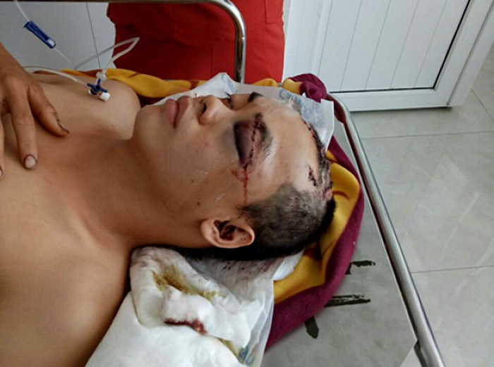 Đã bắt được kẻ sát hại chủ tiệm sửa xe ở Phú Yên