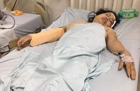     Cầm cây đánh nhiều nhát vào đầu người vợ cũ