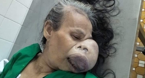 Tìm thân nhân nữ bệnh nhân tử vong chưa rõ tung tích