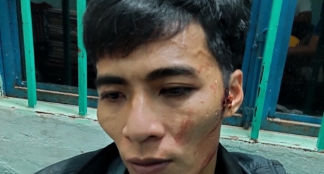 Bắt giữ kẻ cướp giật ở miền núi sau nửa giờ truy nóng