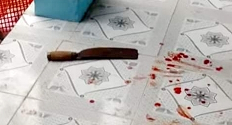 Nữ giáo viên chém đồng nghiệp tại trường