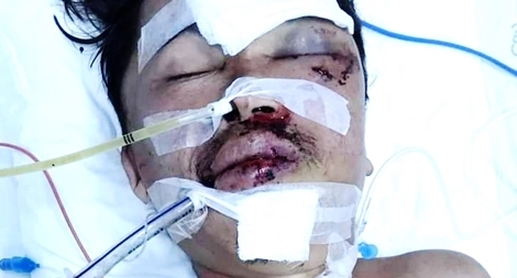 Tìm kiếm thân nhân nạn nhân TNGT trong tình trạng hôn mê