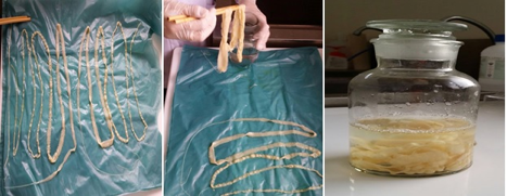 Phát hiện ổ bệnh sán dây lợn ở Bình Phước 