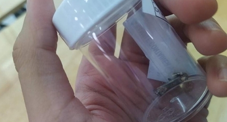 Lấy miếng kim loại bám trong  phổi cháu bé  