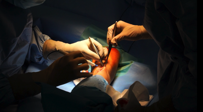 Nam bệnh nhân đột ngột tăng 15 kg trong 5 ngày được cứu sống 