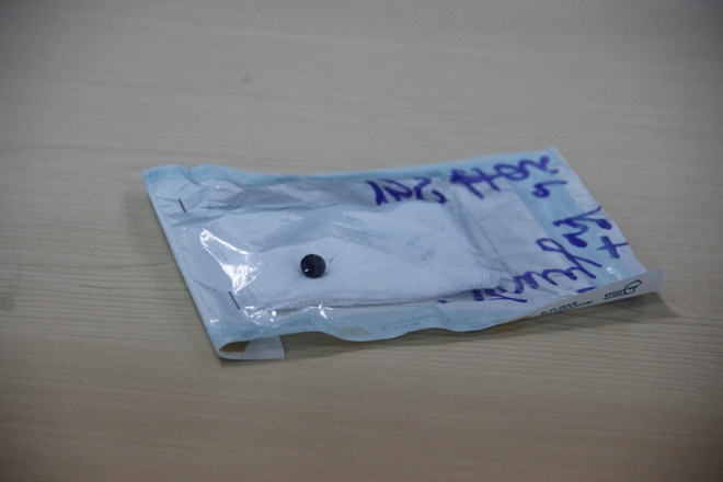 Đang đứng trước cửa nhà, người phụ nữ bị đạn bắn xuyên vào mắt