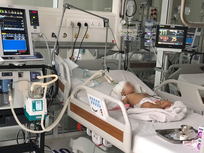 Khỉ nhà hàng xóm tấn công, 1 bé gái chấn thương nguy kịch 