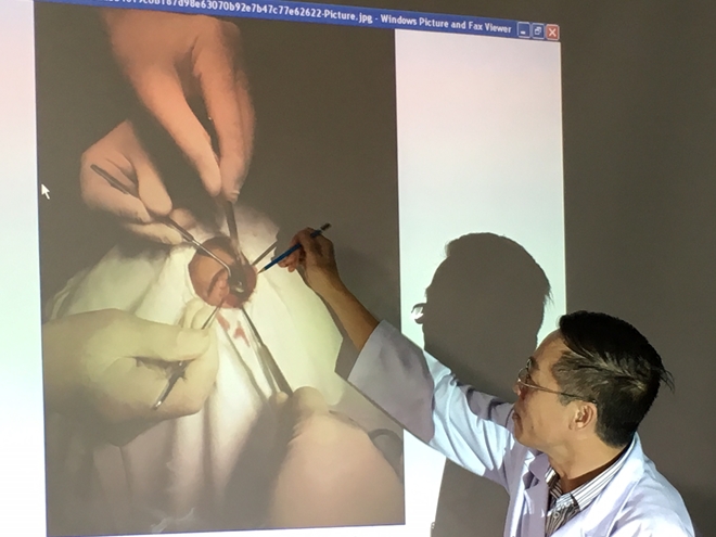 Cậu "nổ súng" găm thẳng đạn vào hốc mắt cháu