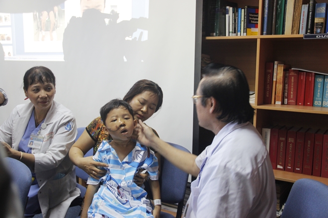 Cha mẹ coi thường việc đội mũ bảo hiểm, nhiều trẻ đa chấn thương vùng mặt 