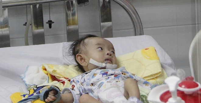 5 giờ tái tạo nhịp tim cho bé gái 2 tháng tuổi