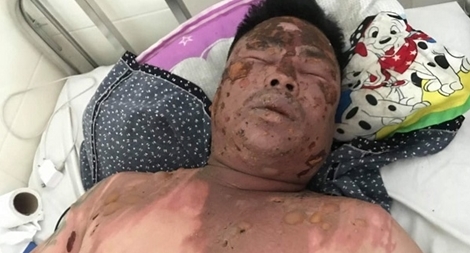 Hỏi tuổi bố bạn nhậu, bị hất cả nồi lẩu vào mặt