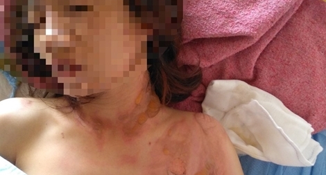 Đang đi đường, bị tạt xăng phóng hỏa