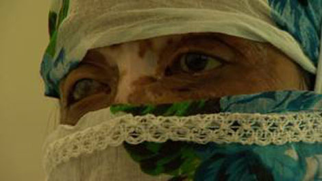 Đội ngũ y bác sĩ tự nguyện và các nạn nhân bị acid hủy hoại