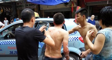 Nổ bình gas, chủ quán cơm bình dân phải nhập viện cấp cứu