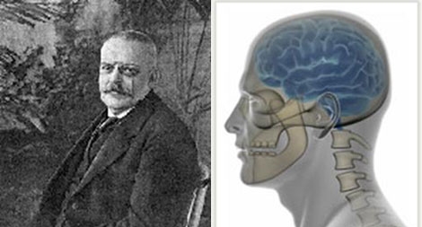 Alzheimer – Căn bệnh của thế kỷ XXI